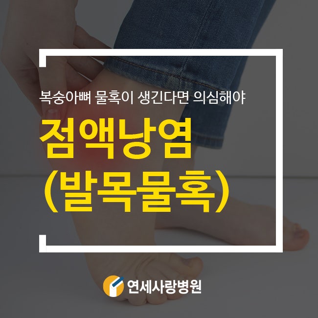 발목점액낭염 복숭아뼈 물혹이 생긴다면 주의해야!