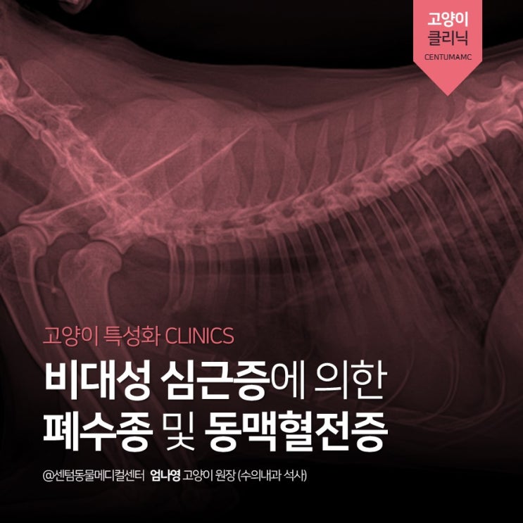  비대성심근증(HCM)에 의한 폐수종 및 동맥혈전증 (부산 고양이 친화병원 센텀동물메디컬센터)