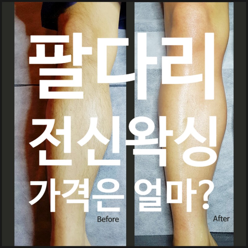팔다리 포함 남자 전신왁싱 가격은 얼마일까? : 네이버 블로그