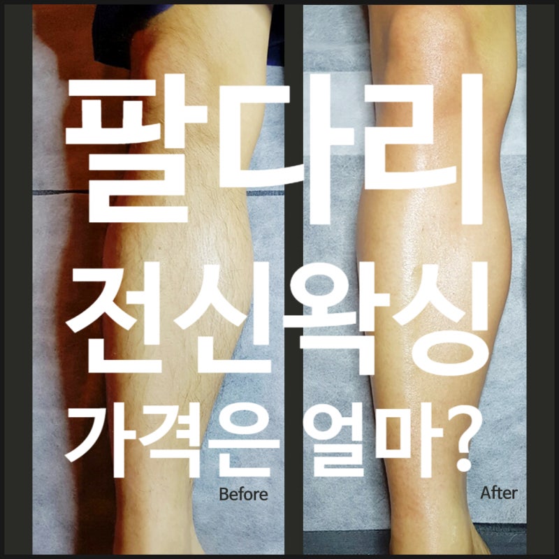 팔다리 포함 남자 전신왁싱 가격은 얼마일까? : 네이버 블로그 팔다리 포함 남자 전신왁싱 가격은 얼마일까? : 네이버 블로그