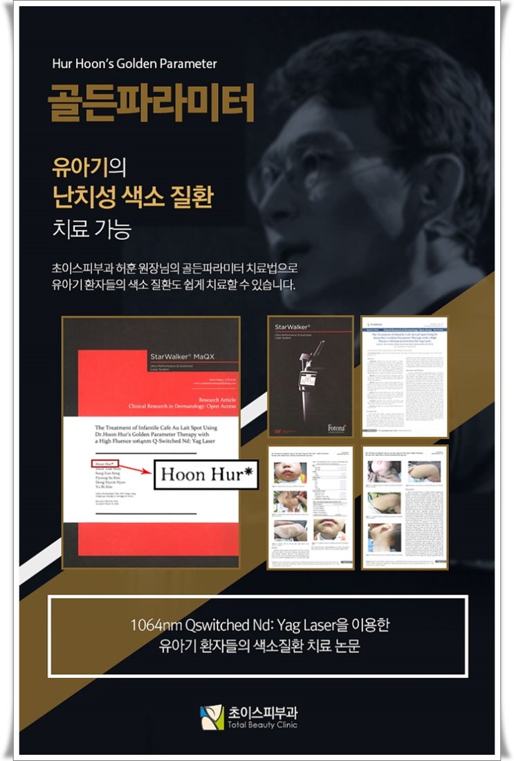  평촌색소치료 누구나 꿈꾸는 애기같은 깨끗한 피부