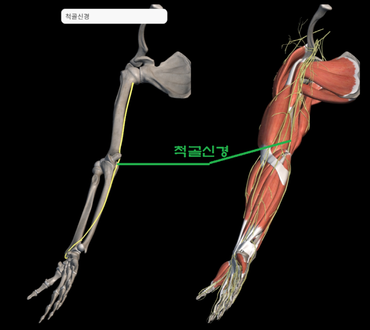 척골 신경 포착 증후군, 팔꿈치 터널 증후군, 주관절 터널 증후군, 척골관 증후군