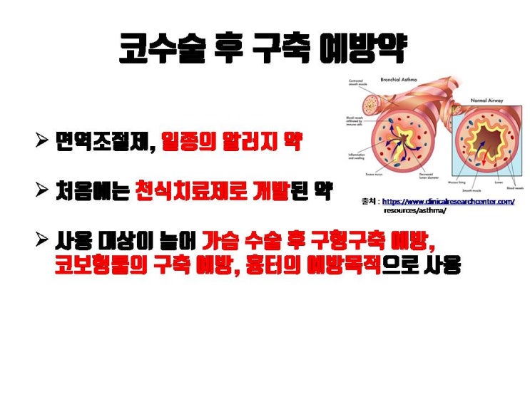 가장 심각한 코수술 부작용인 코수술 구축의 예방약이 있다고?