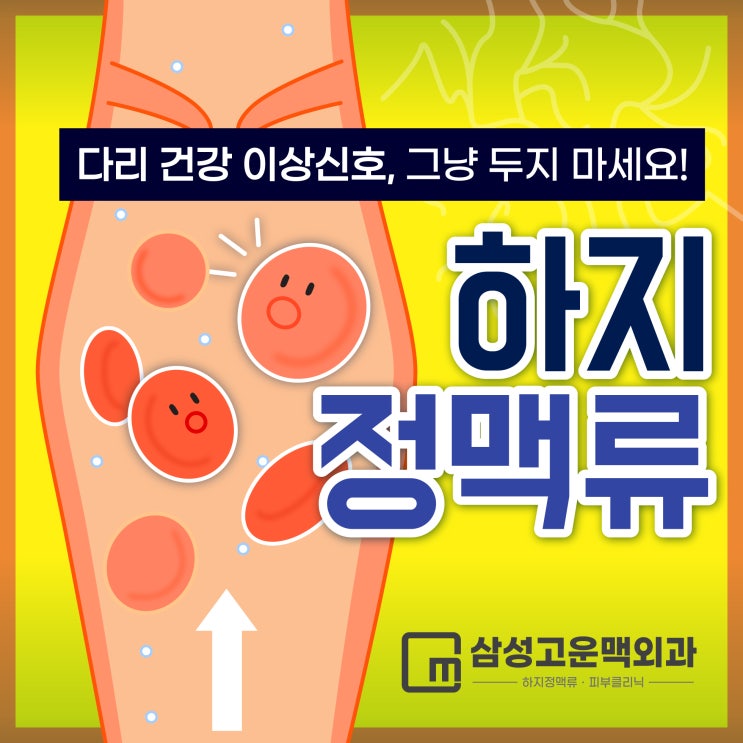  방화동하지정맥류 정확한 검사를 위해 혈관초음파검사 필수!