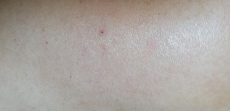 모더나 백신 접종하고 하루 지나니 근육통이 난다.