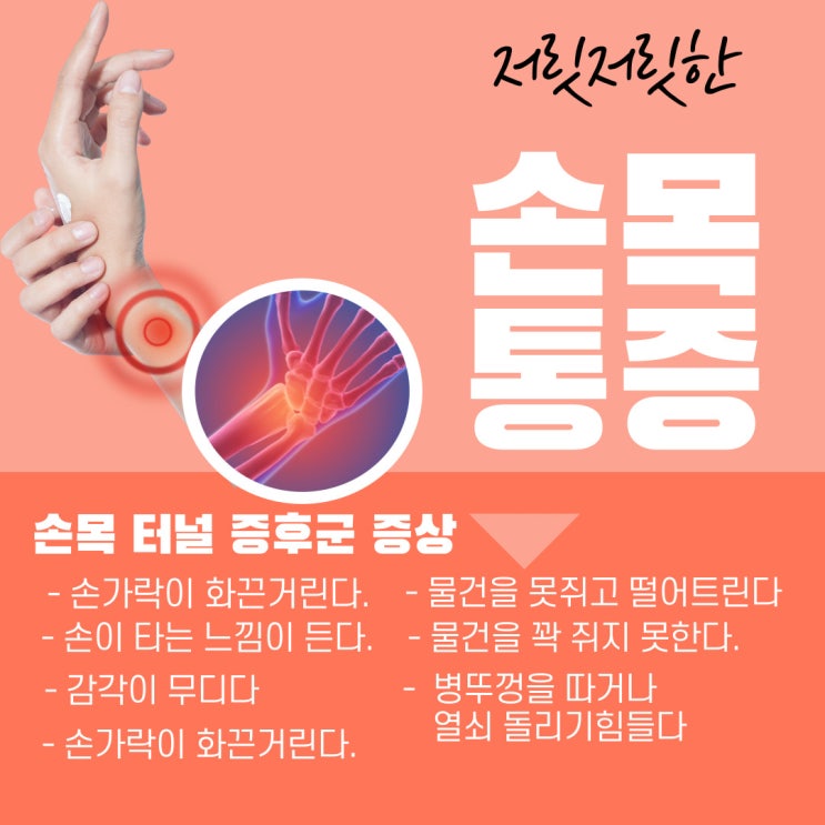  명절 대표 질환 손목터널 증후군에 좋은 한방치료