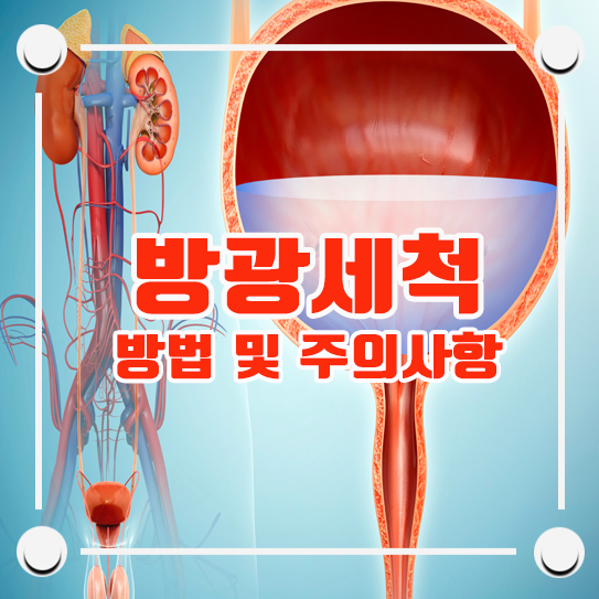 방광세척 방법과 주의사항