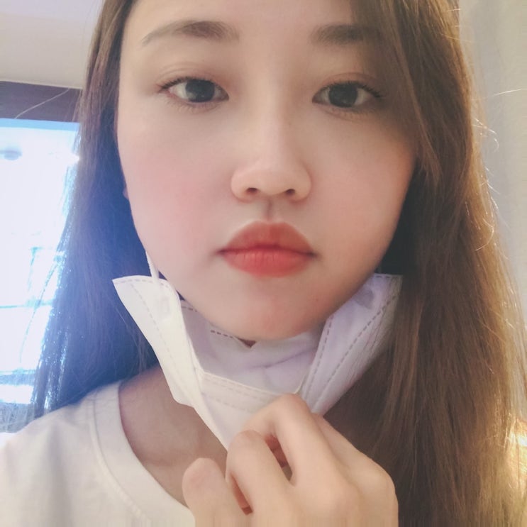  잠실 피부과 자갈턱 보톡스 일주일 후기 (내돈내산)