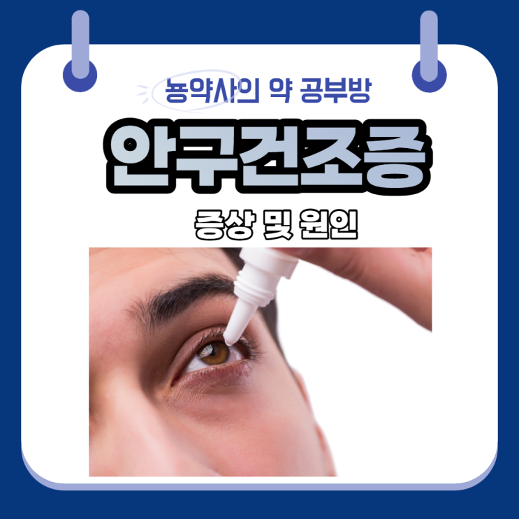  [뇽약사] 안구건조증 1탄, 눈물의 구성성분, 증상, 원인, 예방 및 동반질환(당뇨, 류마티스, 결막염, 라식, 라섹, 갑상선, 쇼그렌증후군)