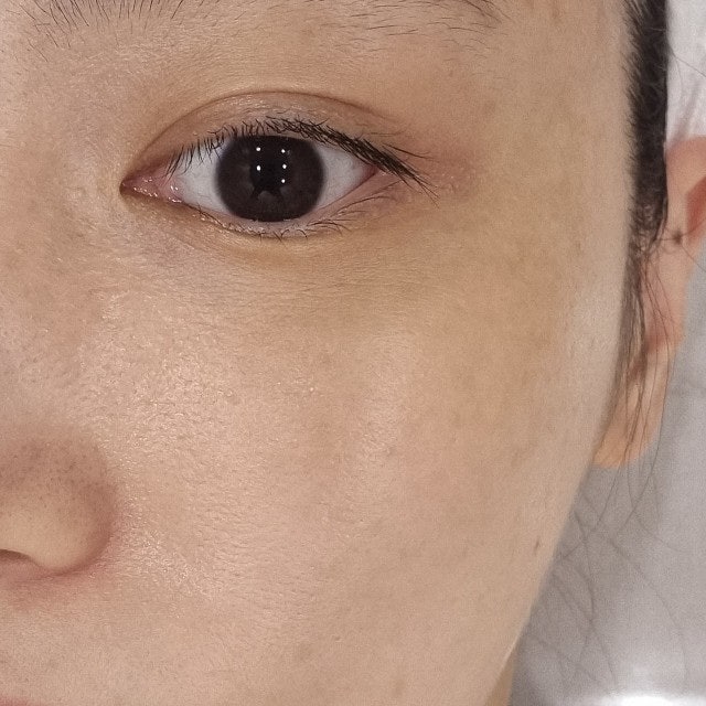 압구정로데오 피부과 닥터이레이저