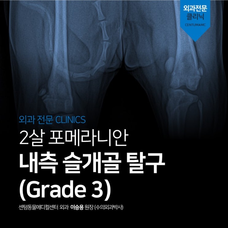  2살 포메라니안 좌측 내측 슬개골 탈구, Grade 3 (부산 외과수술 전문 동물병원 센텀동물메디컬센터)