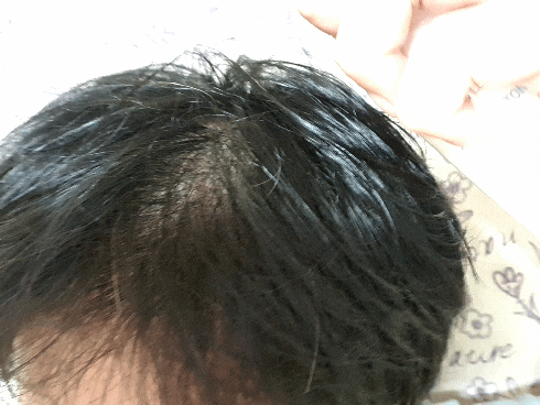  두피관리 두피쿨링 진저(생강) 앤 레몬 두피앰플토닉