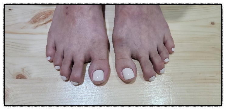  남양주 다산동 내성발톱, 무좀발톱, 발각질 벨라샵 너무좋네요~