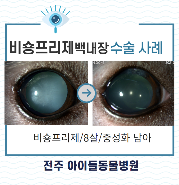 비숑 백내장 수술 합병증과 성공 사례