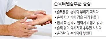  손목터널증후군 원인증상 손목통증부위특징 약물수술치료진단 수근관증후군 팔렌검사티넬징후 간호진단과정