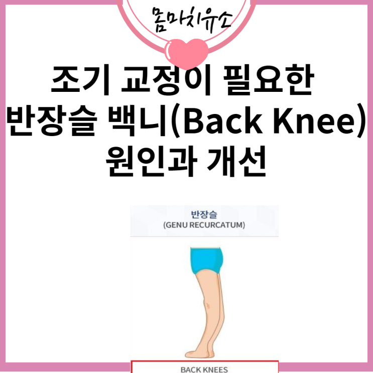 조기 교정이 필요한 반장슬 백니(Back Knee) 원인과 개선