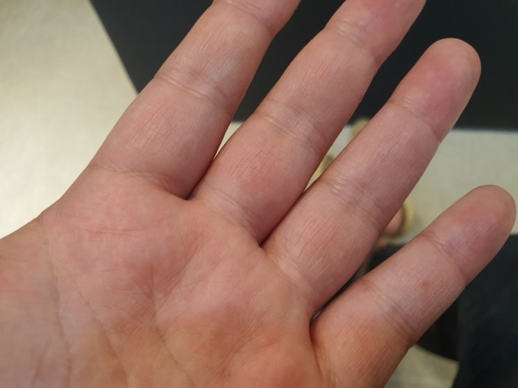  모더나 부작용 접종 일주일 손가락 이상 혈전검사 심장초음파 후기