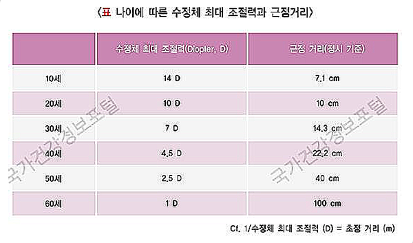 노안 초기증상 예방 및 연령교정수술 개선