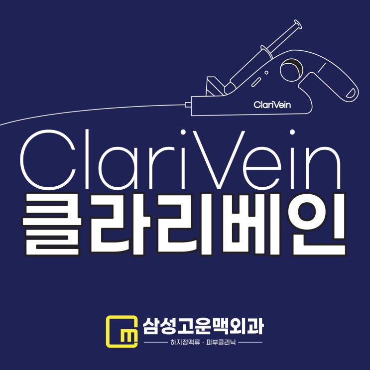  강서구하지정맥류 한번에 치료가 가능한 클라리베인 수술