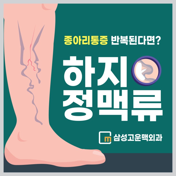 마곡역외과, 무거운 다리 종아리통증 반복되면 하지정맥류 증상?