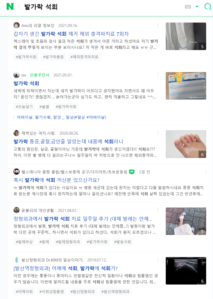 블로그 운영 네 달 일기