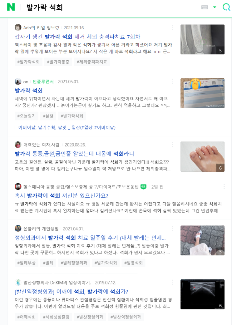 블로그 운영 네 달 일기