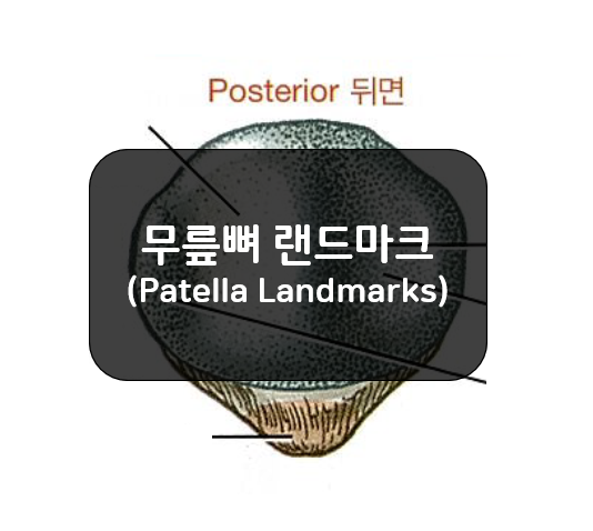  무릎뼈의 랜드마크(Patella Landmarks)