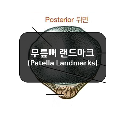 무릎뼈의 랜드마크(Patella Landmarks)