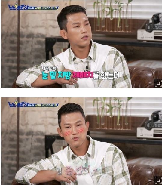 조준호, 달라진 외모…“눈밑지방 재배치” 고백 (노는브로2)