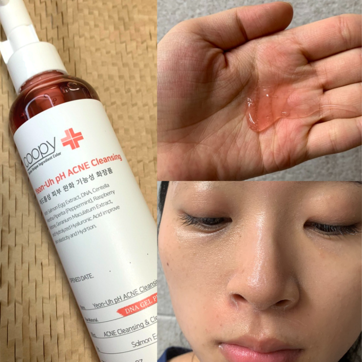 좁쌀여드름클렌징 홈케어추천 쿠피 아크네 약산성폼클렌징젤 좁쌀여드름클렌징 홈케어추천 쿠피 아크네 약산성폼클렌징젤