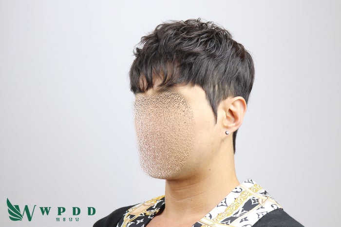 대구 항암가발 후회없는 선택을 하고 싶다면 'click' [대구 위풍당당] 8