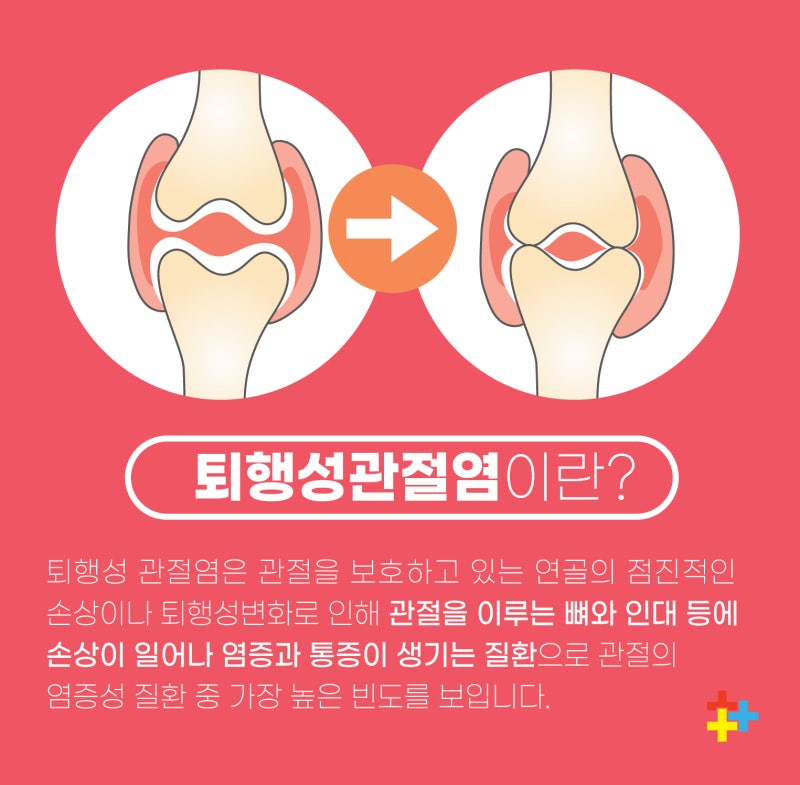 갈현동정형외과 무릎통증 원인 질환