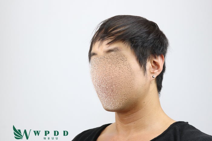 대구 항암가발 후회없는 선택을 하고 싶다면 'click' [대구 위풍당당] 9