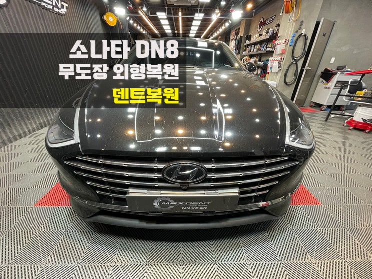  부평덴트 깔끔하고 신속한 복원으로!