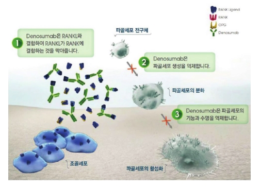  뼈 전이와 데노수맙(Denosumab)