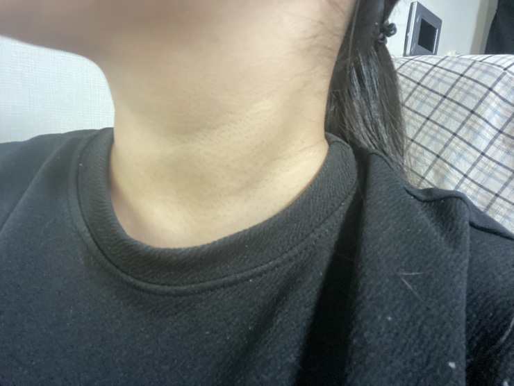  목크림 꾸준히 발라볼까? 듀어썸 넥크림 사용해 볼게요.
