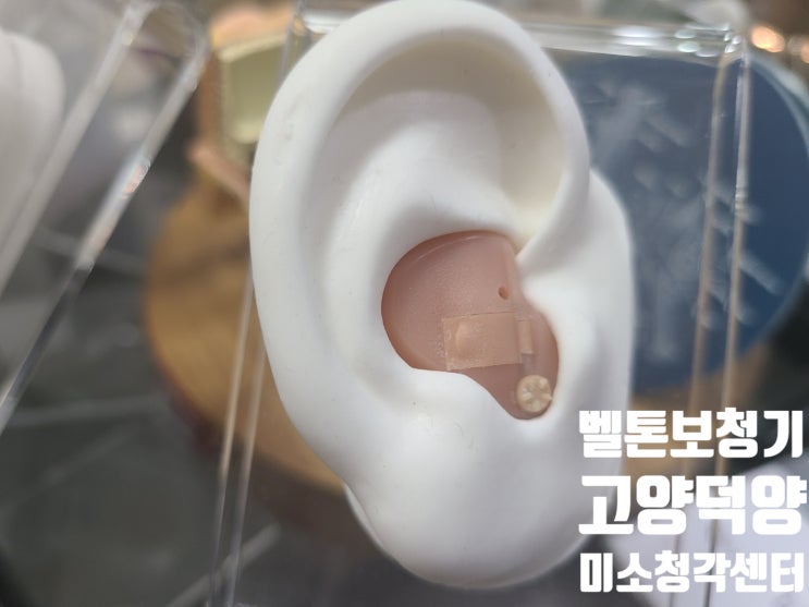  귓속형보청기와 귀걸이형보청기의 장점과 단점?