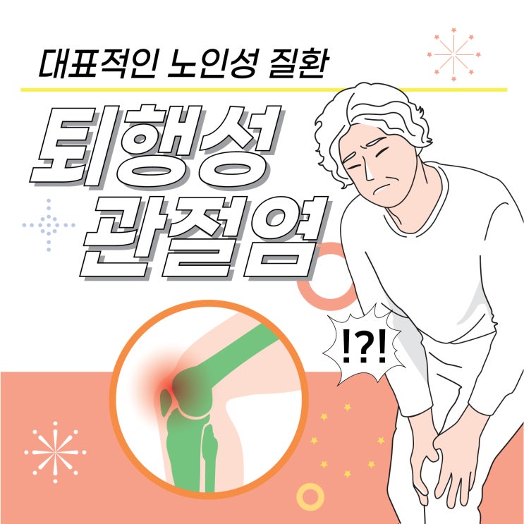  의정부무릎관절염, 대표적인 퇴행성질환 한방치료는?