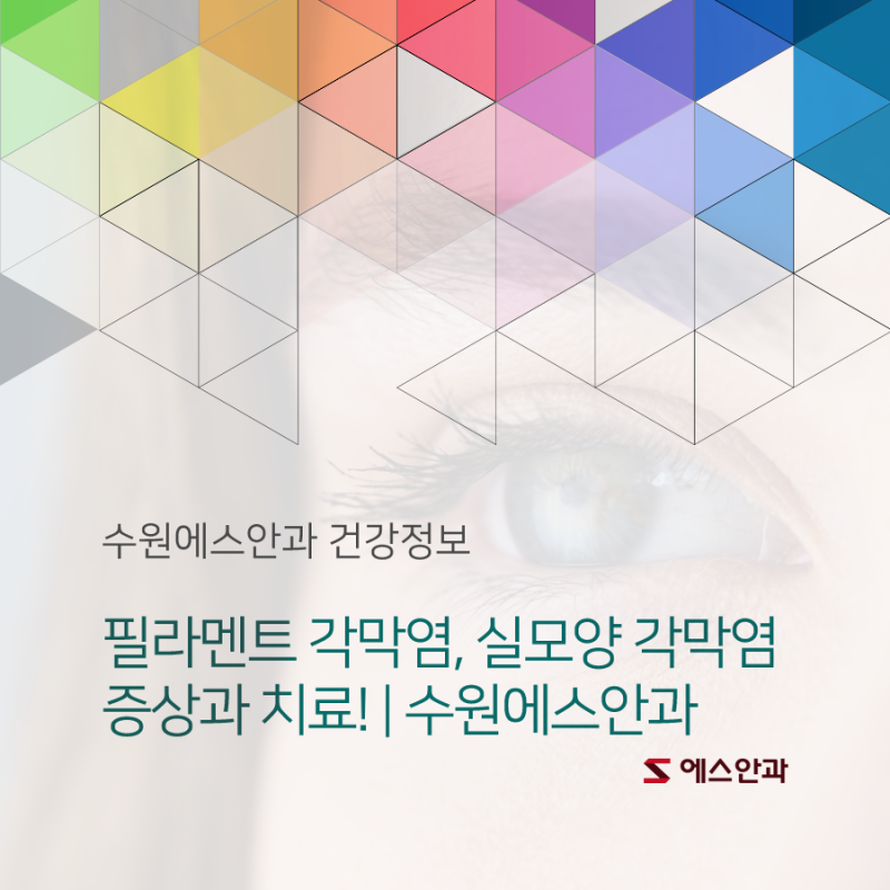 필라멘트 각막염, 실모양 각막염 증상과 치료! | 수원에스안과