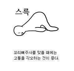 연골주사, 꼬리뼈주사를 맞을 때 고통을 각오하는 것이 좋다. 꼬리뼈 신경주사 통증