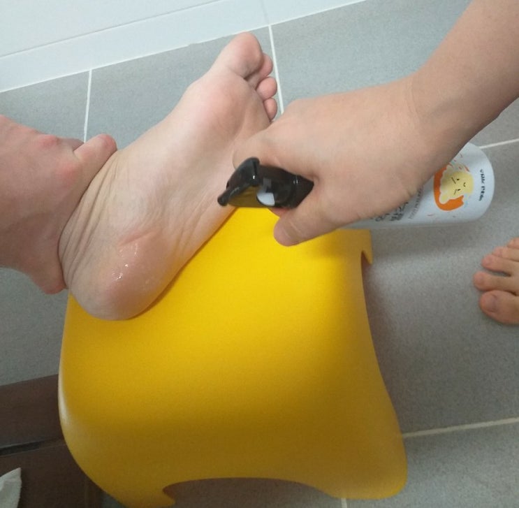  발각질 제거 역대 대반전, 발꿈치 제거 믿을만해요?
