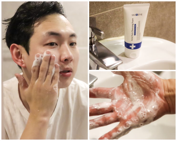  미세먼지 클렌징 99% 검증된 청소년 여드름 화장품 추천