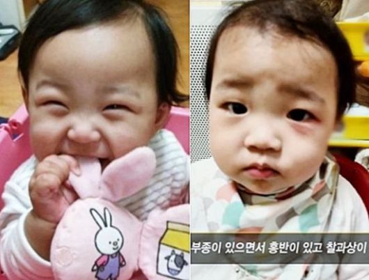 "교과서에 실릴만한 아동학대" 췌장까지 파열돼 숨져…"양부모, 살인죄 적용하라" 공분 "교과서에 실릴만한 아동학대" 췌장까지 파열돼 숨져…"양부모, 살인죄 적용하라" 공분