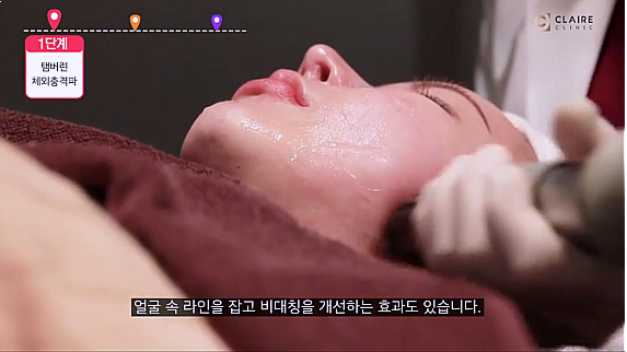  탬버린윤곽술 가격? 비용은 이 정도면 충분합니다