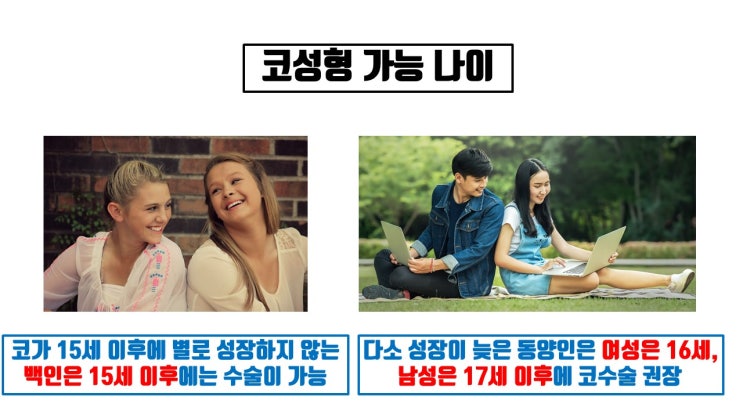  중학생 코수술과 고등학생 코수술, 코수술 가능한 나이는?