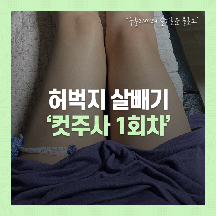  컷주사로 허벅지살빼기 1회차 리뷰!