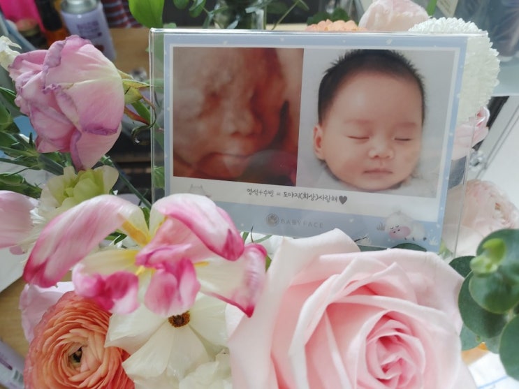 내돈주고 한 두 번째 - 입체 초음파사진 이용한 아기얼굴 예측 , 베이비 페이스
