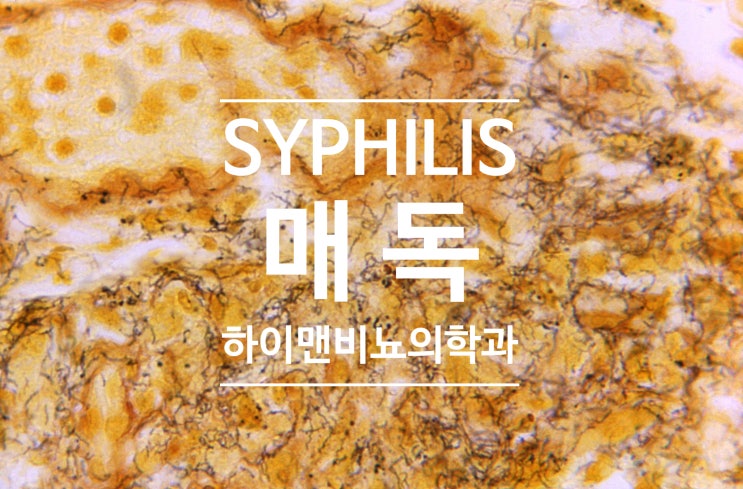  남자 여자 매독 증상과 사진