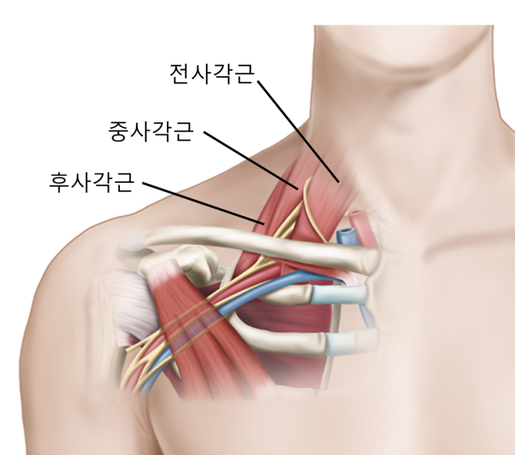  일산, 사각근 (1부) - 팔저림을 유발하는 상완신경총 포착, 흉곽출구증후군 - 가로세로한의원 일산점
