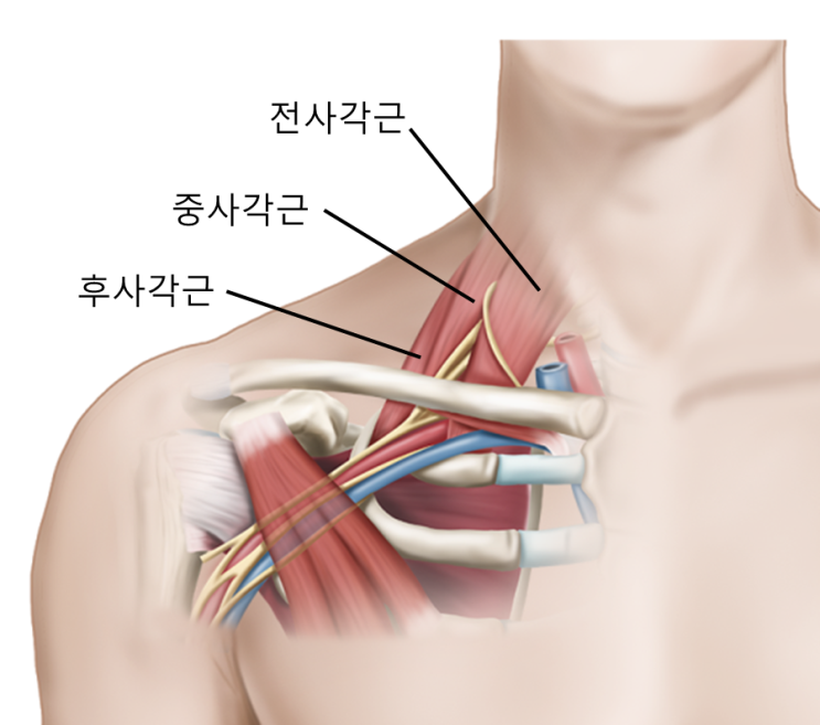 일산, 사각근 (1부) - 팔저림을 유발하는 상완신경총 포착, 흉곽출구증후군 - 가로세로한의원 일산점